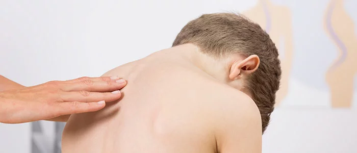 Chiropractic For Scoliosis in Mt Carmel - Advance Chiropractic